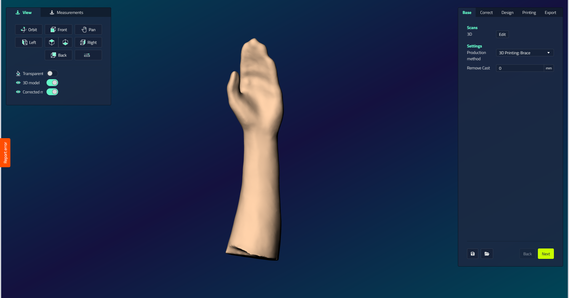 Der Basisschritt einer Handschiene zeigt den Scans-Abschnitt mit einer 3D-Bearbeitungstaste und Einstellungen mit der Dropdown-Stufe der Produktionsmethode, die auf 3D-Druck eingestellt ist: Brace und ein Remove Cast-Feld